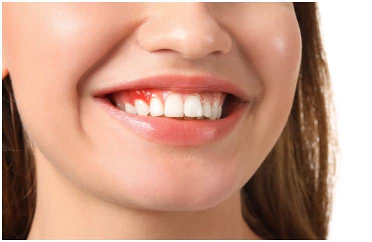 what-is-the-spiritual-meaning-behind-teeth-problems-wisdom-teeth