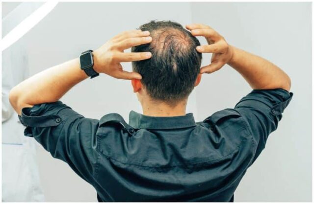 hair-loss-spiritual-cause-meaning-and-healing-insight-state