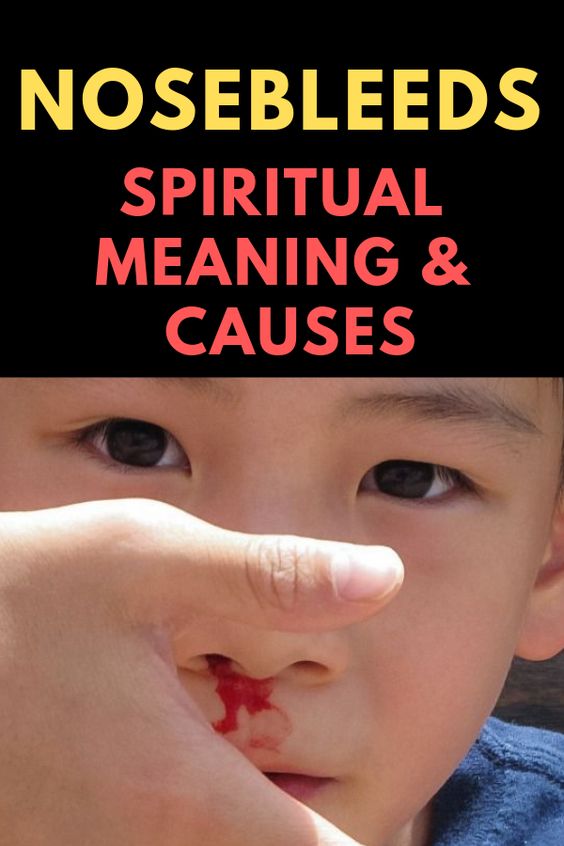 Nosebleeds Epistaxis Spiritual Meaning Causes Insight State